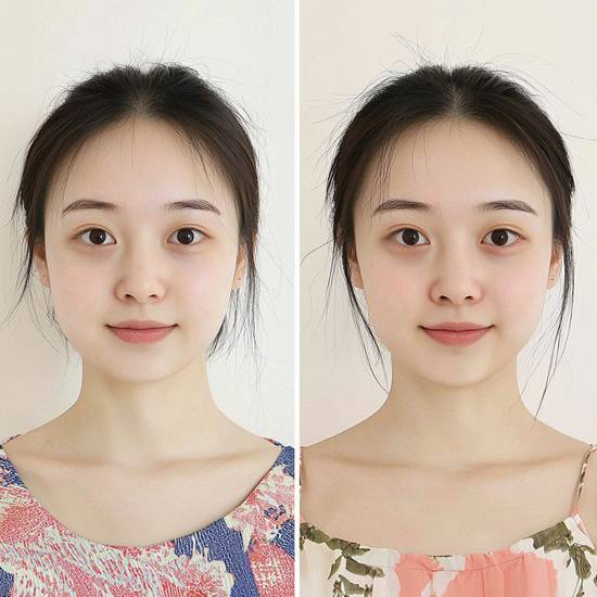 菱形臉怎么改變臉型,菱形臉重塑柔美臉型